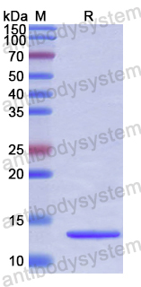 Recombinant Human DNMT3B Protein, N-His