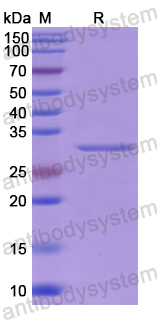 Recombinant Human MYO1A Protein, N-His