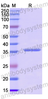 Recombinant Human GALP Protein, N-GST