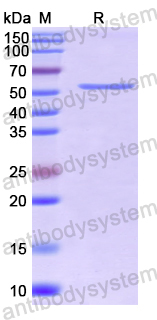 Recombinant Human CD280/MRC2 Protein, N-His