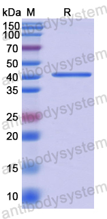 Recombinant Human HDAC6 Protein, N-His
