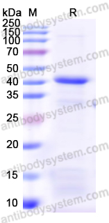 Recombinant Human DKK3 Protein, N-His
