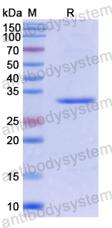 Recombinant Human UPB1 Protein, N-His