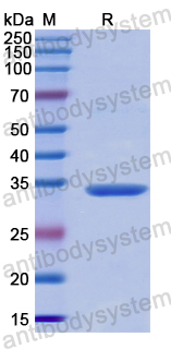 Recombinant Human CTSZ Protein, N-His