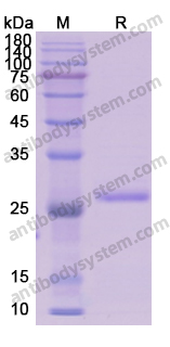 Recombinant Human DKK2 Protein, N-His