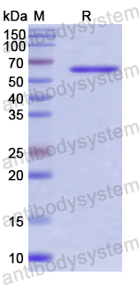 Recombinant Human WNT16 Protein, N-GST