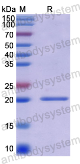 Recombinant Human HSPB7 Protein, N-His