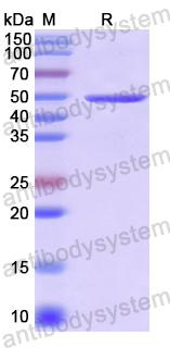 Recombinant Human AASS Protein, N-His