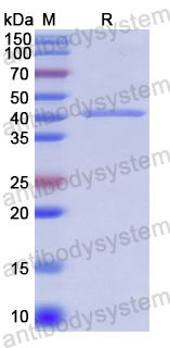 Recombinant Human TJP2 Protein, N-His