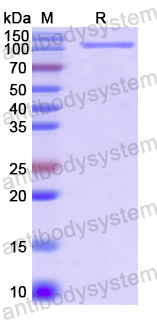 Recombinant Human KL Protein, N-His