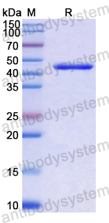 Recombinant Human MARCO Protein, N-His