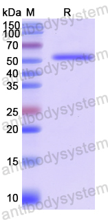 Recombinant Human STK39 Protein, N-His