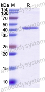 Recombinant Human PARP2 Protein, N-His