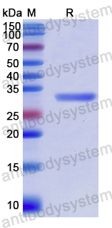 Recombinant Human EBF1 Protein, N-His