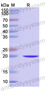 Recombinant Human IL19 Protein, N-His