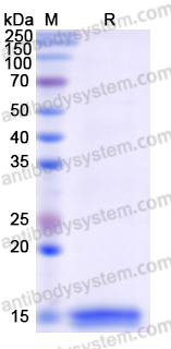 Recombinant Human TBK1 Protein, N-His