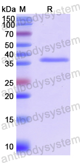 Recombinant Human UBQLN2 Protein, N-GST