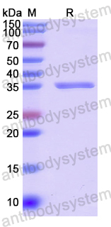 Recombinant Human STEAP1 Protein, N-GST
