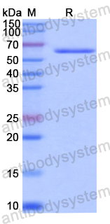 Recombinant Human PCYOX1 Protein, N-GST