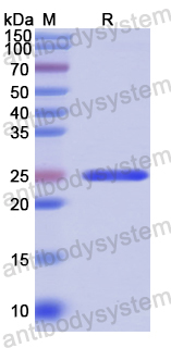 Recombinant Human ADAMTS1 Protein, N-His