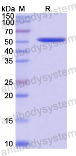 Recombinant Human DPP7 Protein, N-His
