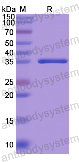 Recombinant Human USP25 Protein, N-His