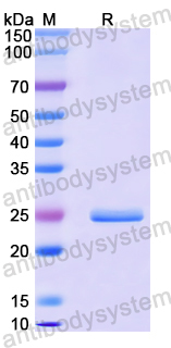 Recombinant Human USP25 Protein, N-His