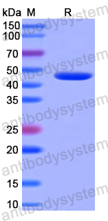 Recombinant Human CYTH4 Protein, N-His