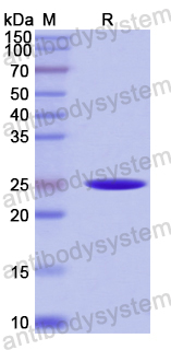 Recombinant Human CD84 Protein, N-His