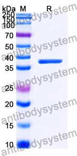 Recombinant Human CD84 Protein, C-His