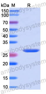 Recombinant Human AK3 Protein, N-His