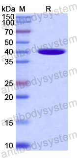 Recombinant Human FKBPL Protein, N-His