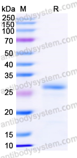 Recombinant Human MBD1 Protein, N-His