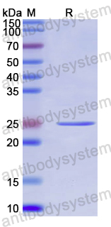 Recombinant Human LEF1 Protein, N-His