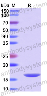 Recombinant Human DBR1 Protein, N-His