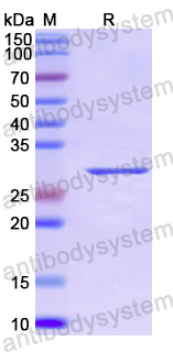Recombinant Human AKAP11 Protein, N-His