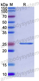 Recombinant Human CROT Protein, N-His