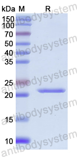Recombinant Human ADAMTS7 Protein, N-His