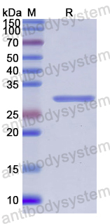Recombinant Human ADAM28 Protein, N-His