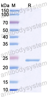 Recombinant Human ADAM28 Protein, N-His