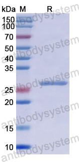 Recombinant Human KLK12 Protein, N-His