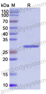 Recombinant Human ANGPTL2 Protein, N-His