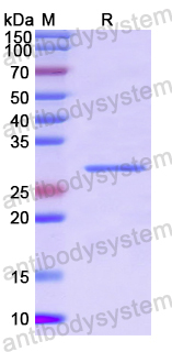 Recombinant Human MYH2 Protein, N-His
