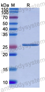 Recombinant Human NUP50 Protein, N-His