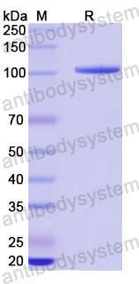 Recombinant Human PADI4 Protein, N-GST & C-His