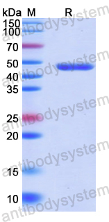 Recombinant Human NOTCH3 Protein, N-His