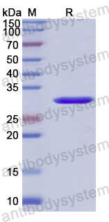 Recombinant Human CD246/ALK Protein, N-His