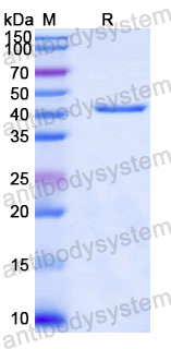 Recombinant Human COL17A1 Protein, N-GST & C-His
