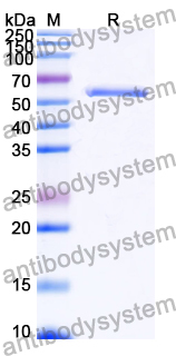 Recombinant Human COL17A1/Bp180 Protein, N-GST & C-His