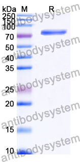 Recombinant Human COL17A1 Protein, N-GST & C-His
